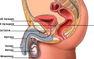 Причины гидроцеле