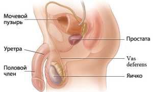 Лечение простаты массажем