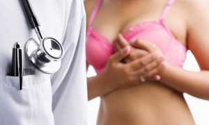 Сколько живут с раком молочной железы 1-4 степени?