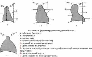 Просто о сложном: конфигурация сердца и ее особенности