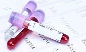 Нормы гормона ТТГ в крови