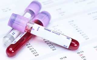 Нормы гормона ТТГ в крови