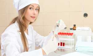 Норма Гликозилированного гемоглобина для здоровых и диабетиков