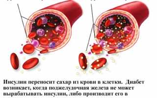 Варианты определения сахара в крови: стандартные приборы и новинки