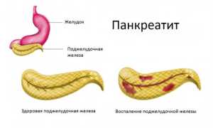 Овес при панкреатите