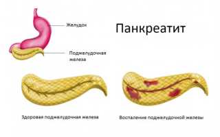Овес при панкреатите