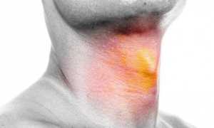 Симптомы гипертиреоза