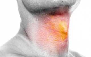 Симптомы гипертиреоза