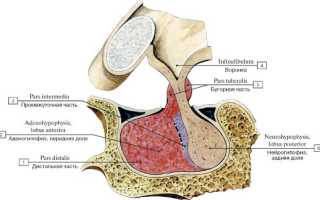 Болезнь Иценко-Кушинга