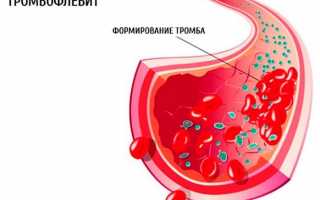 Причины, по которым могут измениться вены на животе