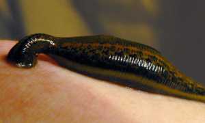 Пиявки при простатите