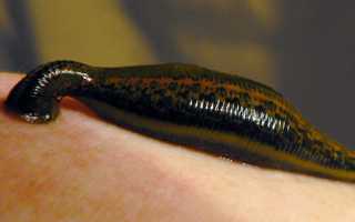 Пиявки при простатите