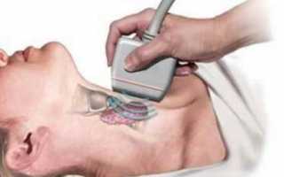 Как подготовиться к УЗИ щитовидной железы?