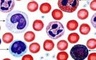 Зачем и кому исследуют лейкоцитарную формулу