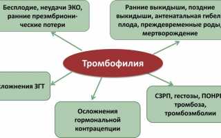 Основная профилактика тромбозов, или как предотвратить закупорку сосудов