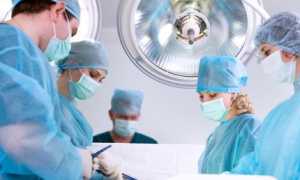 Удаление узлов щитовидной железы