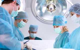 Удаление узлов щитовидной железы