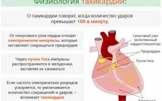 Аритмия при нормальном давлении: норма или патология?