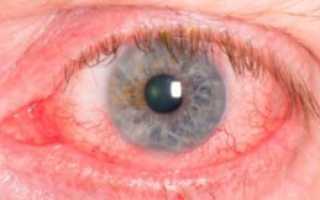 Капли в глаза Сигницеф: инструкция, противопоказания, аналоги