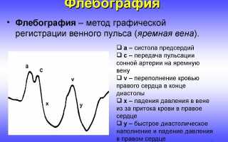 ВПВ или синдром верхней полой вены: причины сдавления, как избежать тяжелых последствий