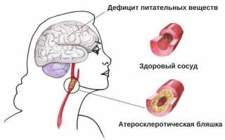 Причины возникновения низкого артериального давления у здоровых людей и при наличии заболевания