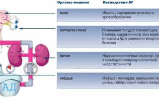 Как помочь при гипертоническом кризе или резком повышении давления