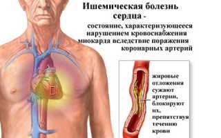 Фактор риска осложнений ишемической болезни — давление при стенокардии