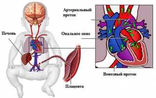 Выявлены шумы в сердце у ребенка: всегда ли надо паниковать?