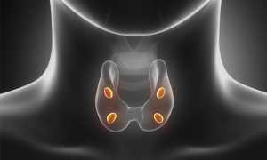 Послеоперационный гипопаратиреоз