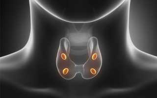 Послеоперационный гипопаратиреоз
