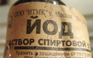 Нехватка йода в организме