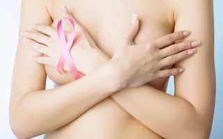 Народное лечение кисты молочной железы