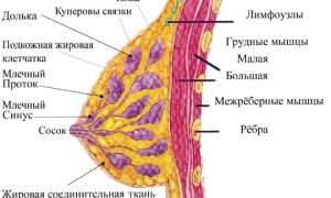 Что такое мастопатия молочных желез?