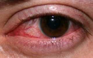 Глазные капли Наклоф: инструкция по применению, аналоги