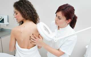 Куда стоит обратиться за помощью при проблемах с кожей: посещение клиники, комплексные действия, итоги