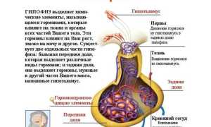 Синдром пустого турецкого седла