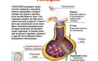Синдром пустого турецкого седла