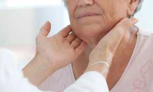 Субклинический гипотиреоз