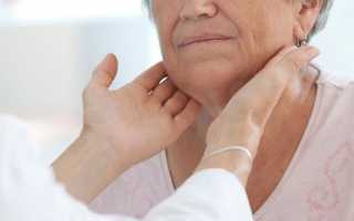 Субклинический гипотиреоз