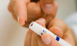 Симптомы низкого сахара