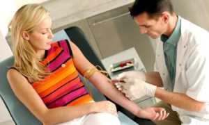 Сдача крови на пролактин