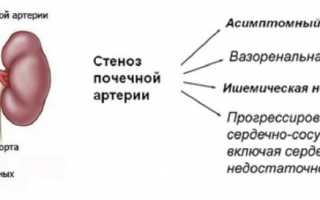 Каптоприл при гипертонии: инструкция, преимущества, противопоказания