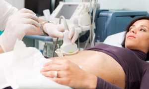 Диффузные изменения поджелудочной железы