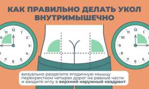 Как правильно колоть витамины?