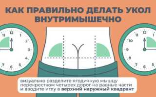 Как правильно колоть витамины?