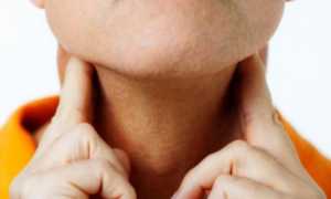 Лечение тиреоидита народными средствами