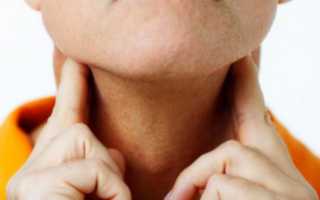 Лечение тиреоидита народными средствами