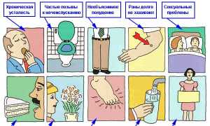Симптомы сахарного диабета у мужчин