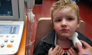 Киста щитовидной железы у ребенка