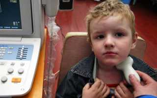 Киста щитовидной железы у ребенка